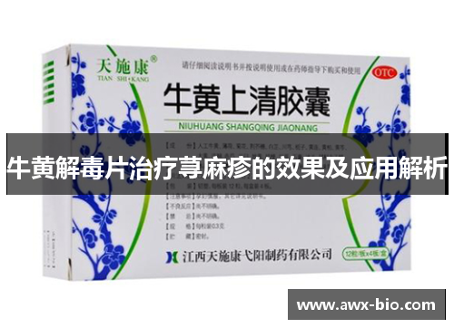 牛黄解毒片治疗荨麻疹的效果及应用解析